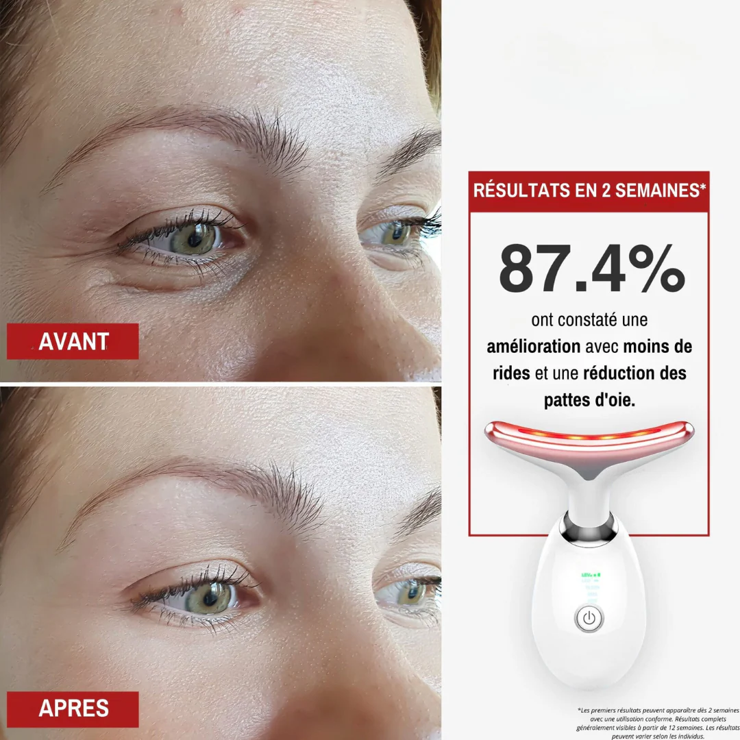 Appareil anti-âge pour le visage à lumière LED - Image 8