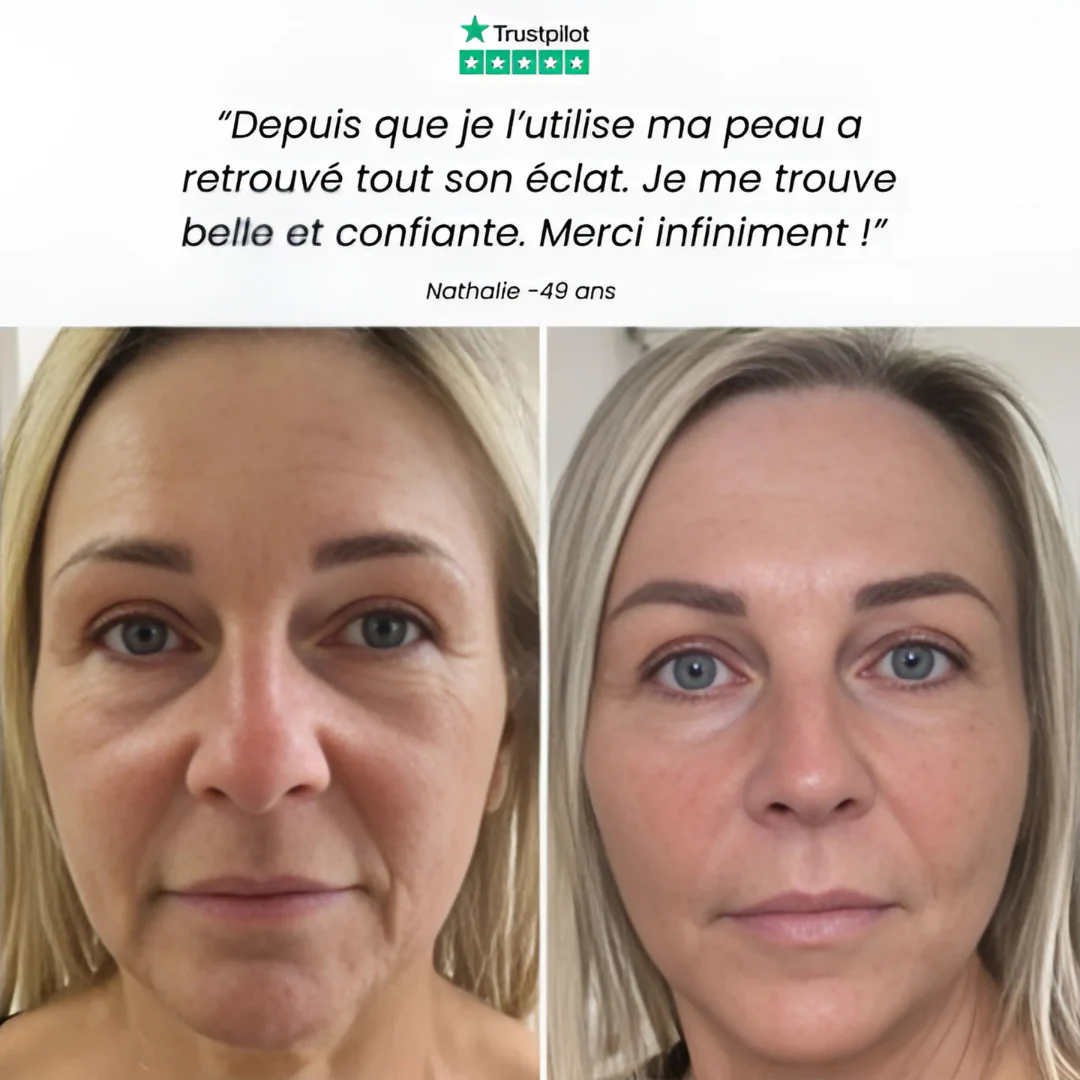 Appareil Anti-Âge Visage LED - Image 9