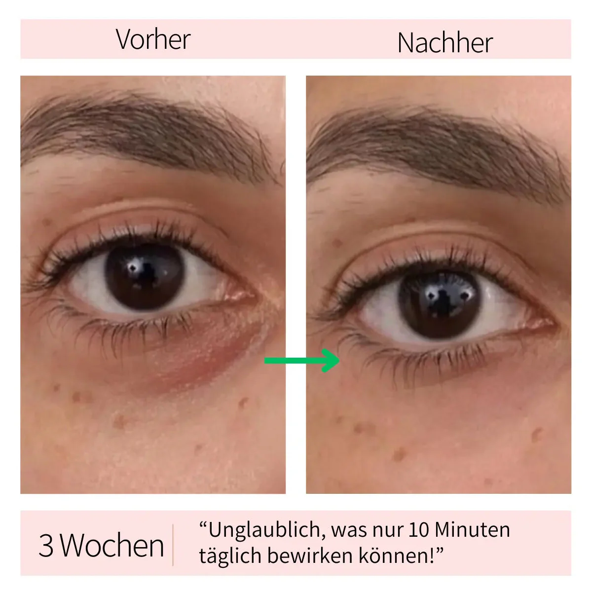 Appareil de massage raffermissant pour les yeux et les poches - Image 2