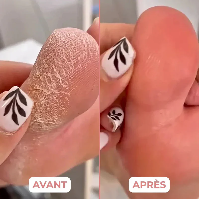 Appareil électrique de soin des pieds - Image 4