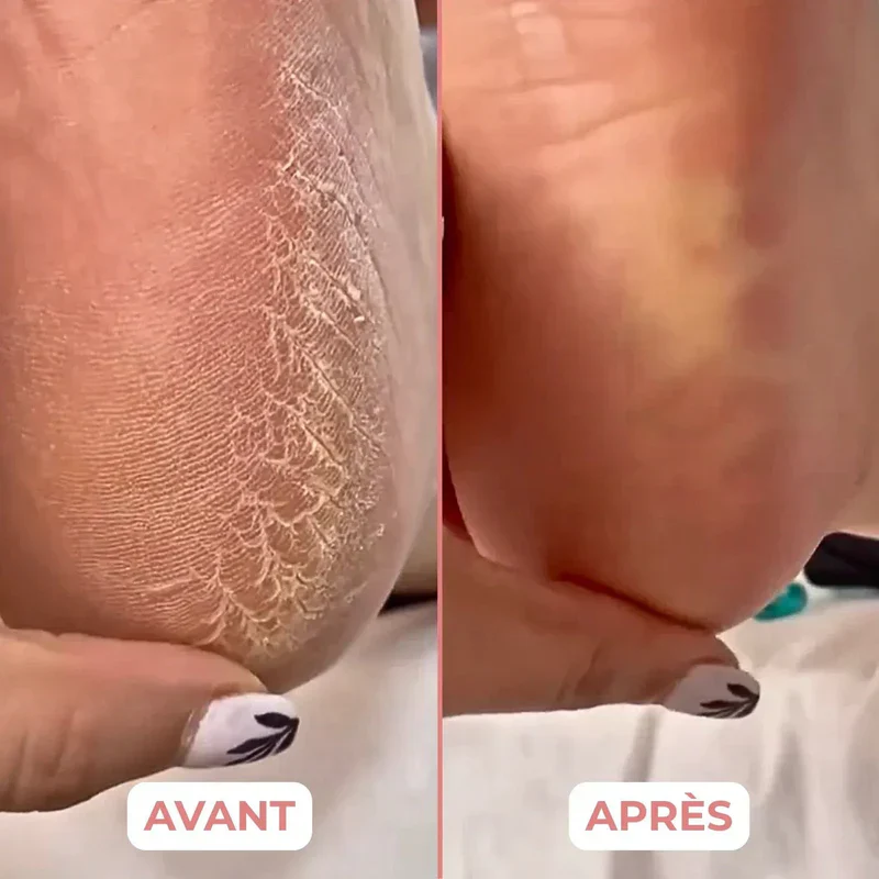 Appareil électrique de soin des pieds - Image 5