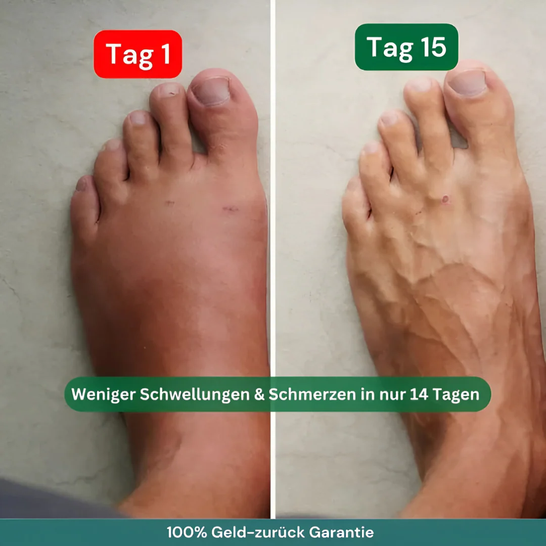 Chaussettes de compression avec soutien tri-zone - Image 11