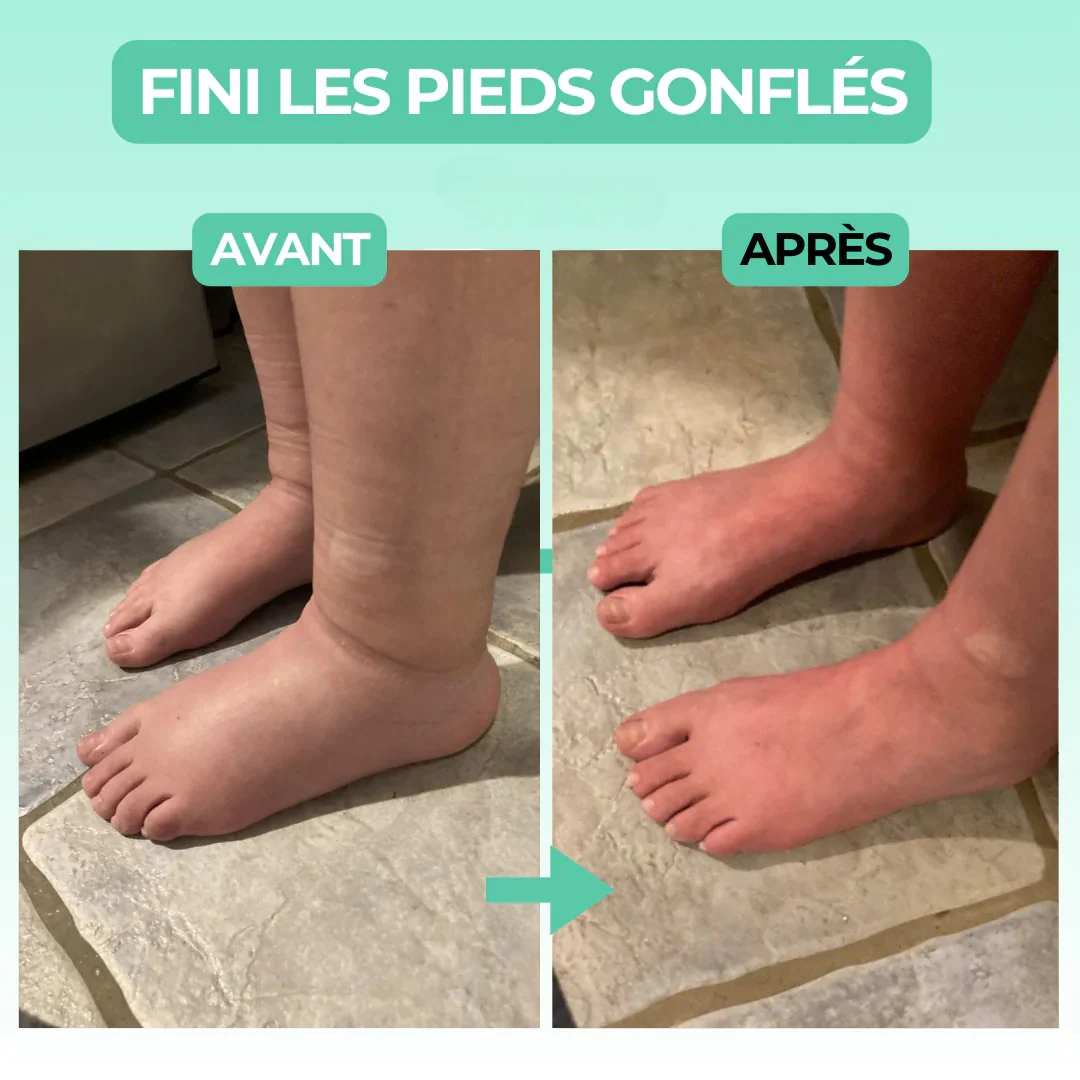 Chaussettes de compression ultra-confort – pour des jambes légères et détendues - Image 2