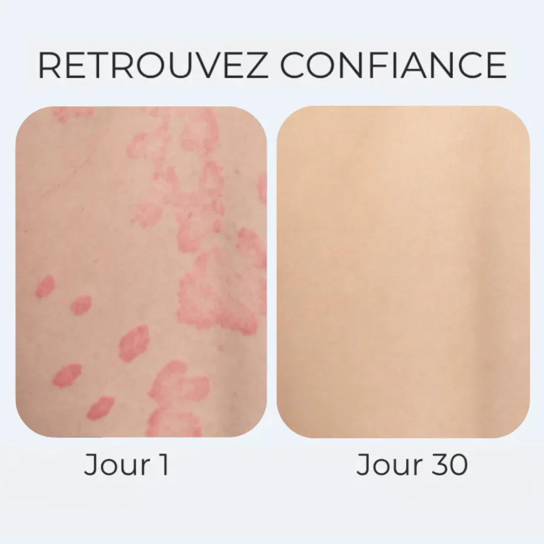 Crème anti-démangeaisons naturelle multi-zones - Image 2