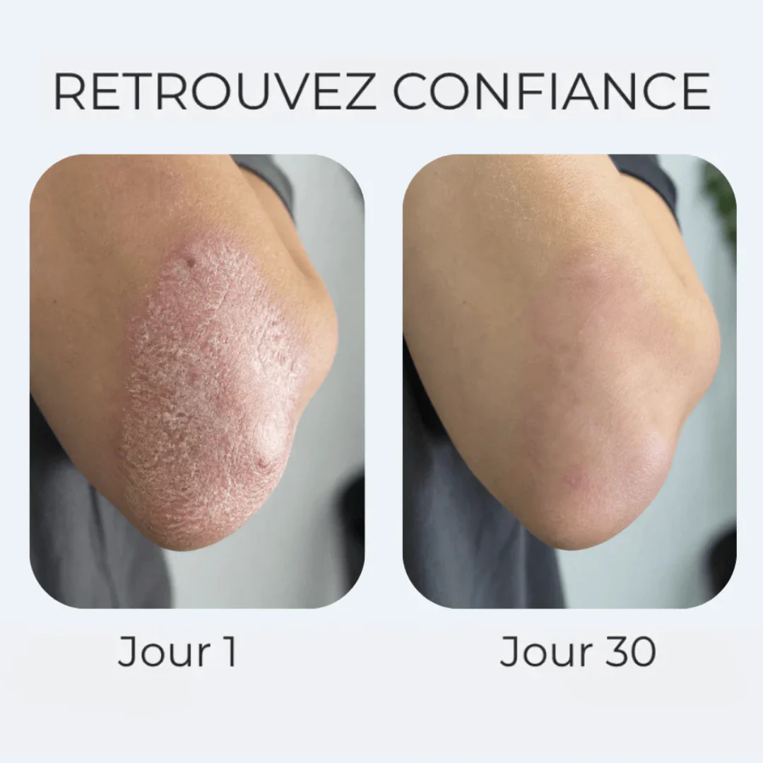 Crème anti-démangeaisons naturelle multi-zones - Image 7