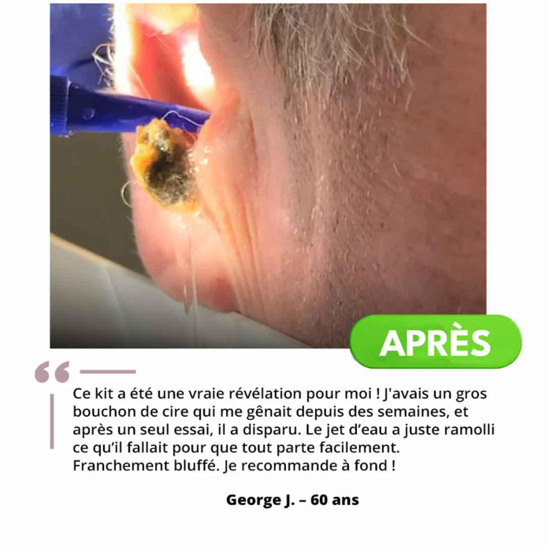 Nettoyeur auriculaire doux et efficace - Image 6