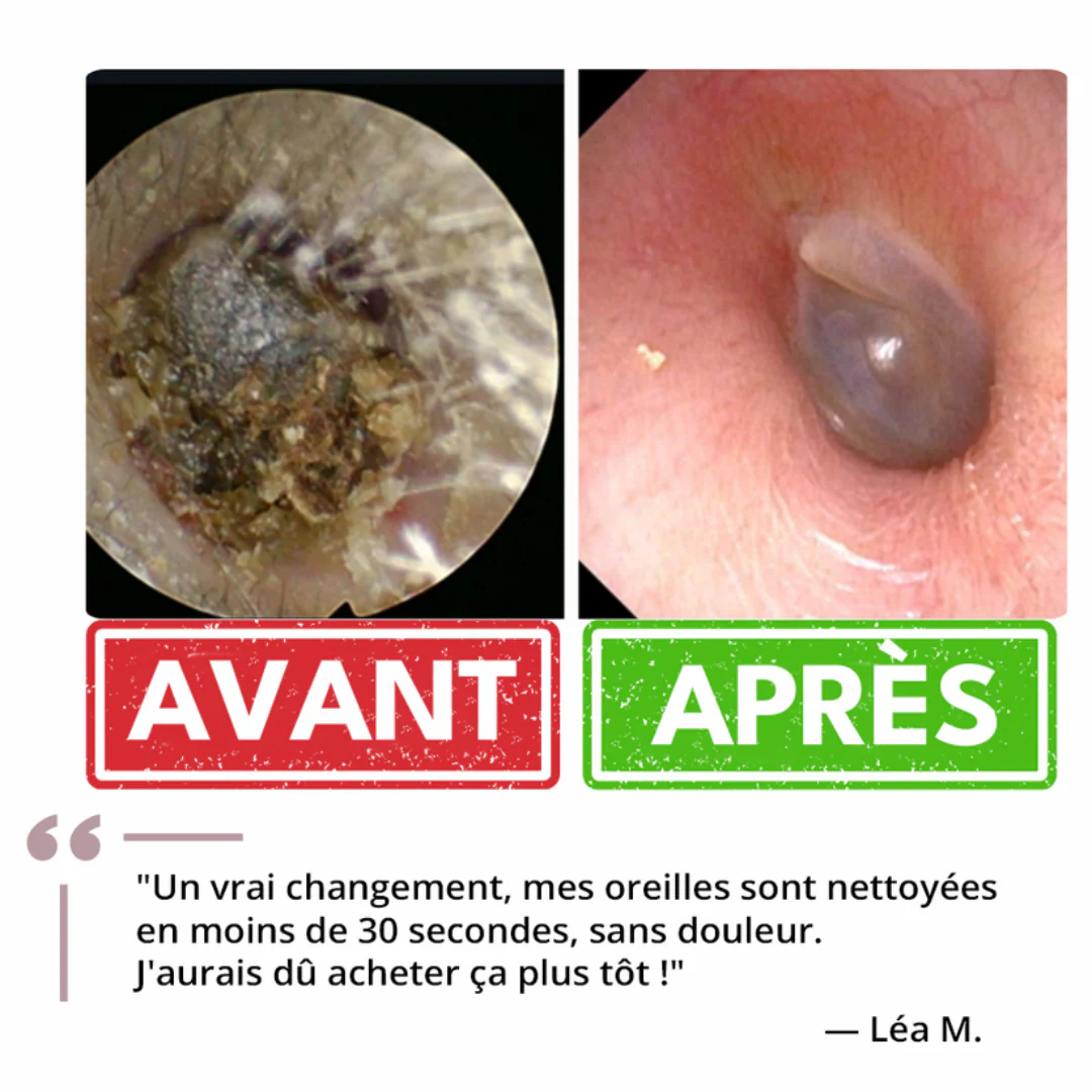Nettoyeur auriculaire doux et efficace - Image 8