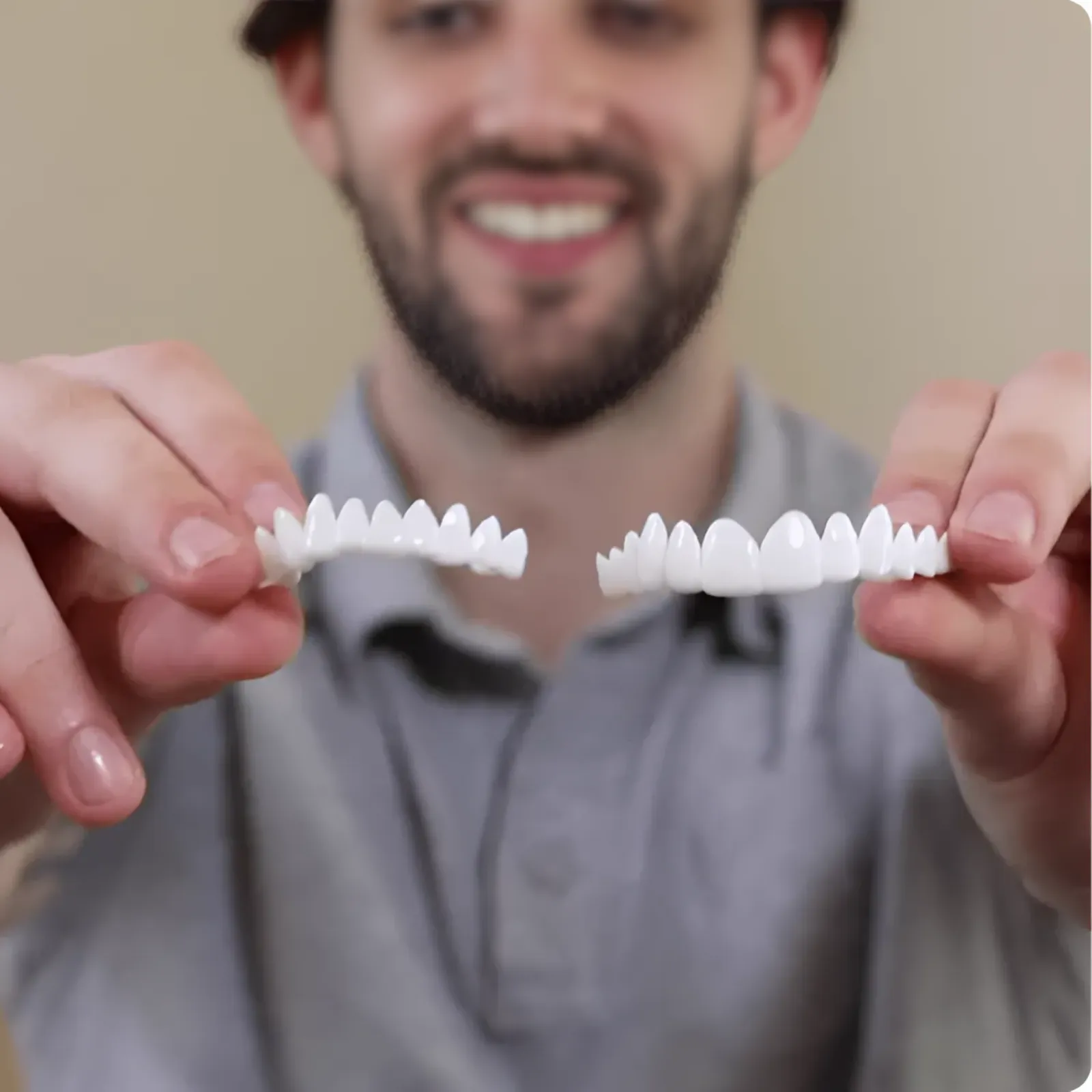 Facettes dentaires souples à clipser – Sourire immédiat