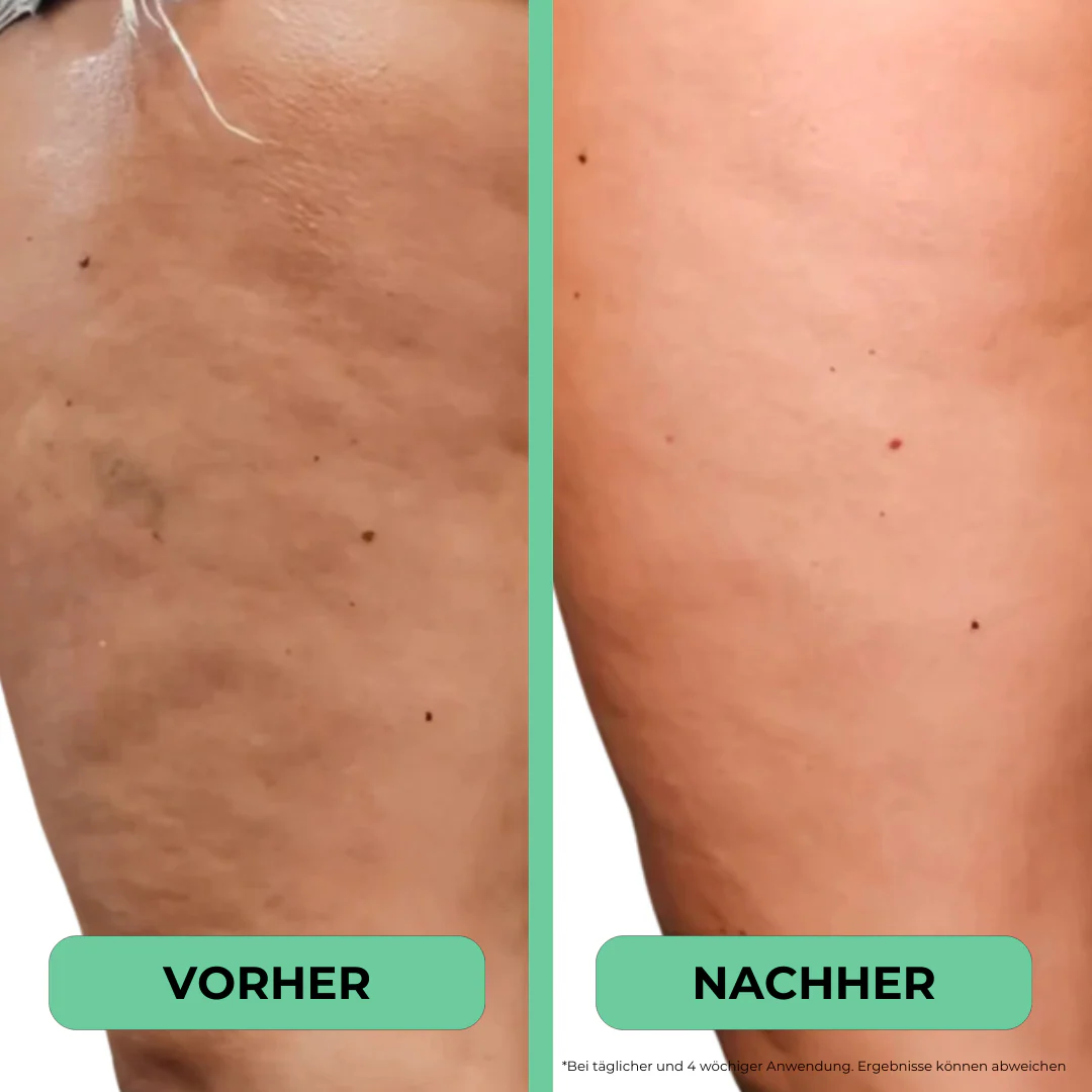FreyaSilka – Votre solution pour une peau lisse et ferme - Image 4