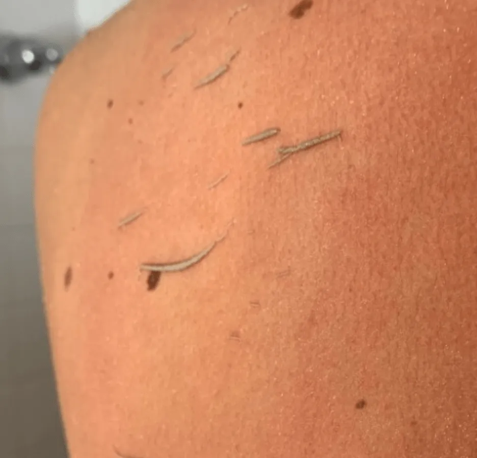 Gant Exfoliant - Élimine les cellules mortes - Image 2