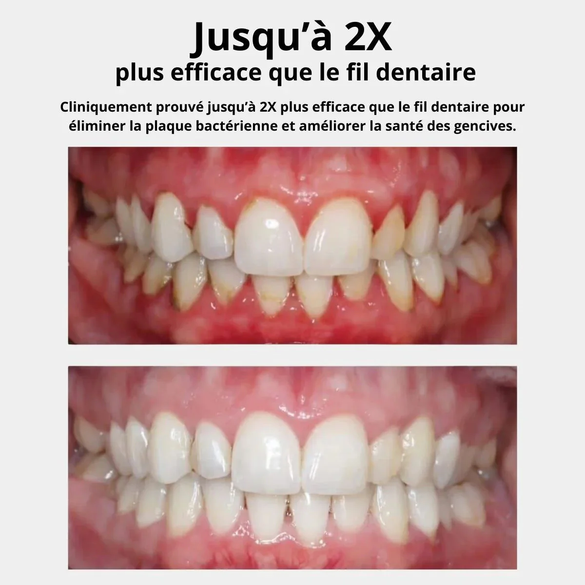 Hydropulseur dentaire - Image 13