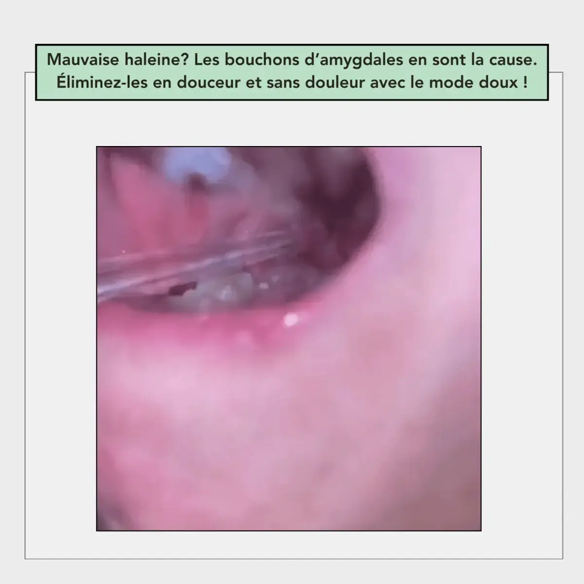 Hydropulseur dentaire - Image 4