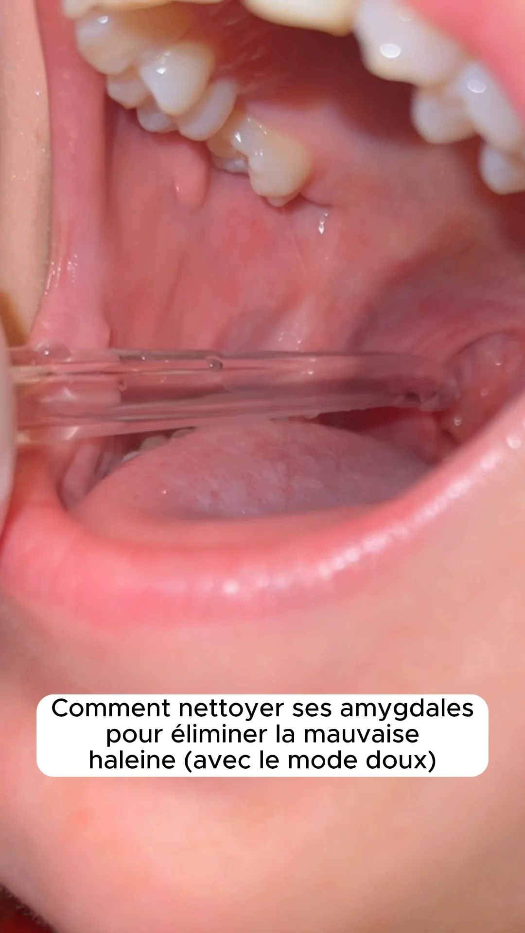 Hydropulseur dentaire - Image 7