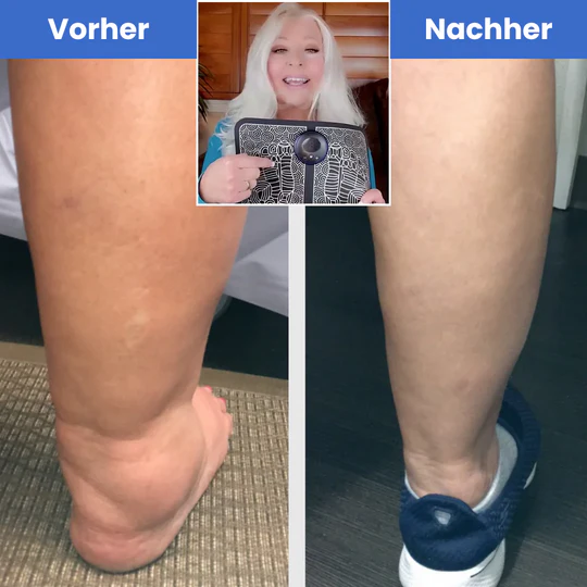 LymphEasePRO – Appareil de massage des pieds - Image 3