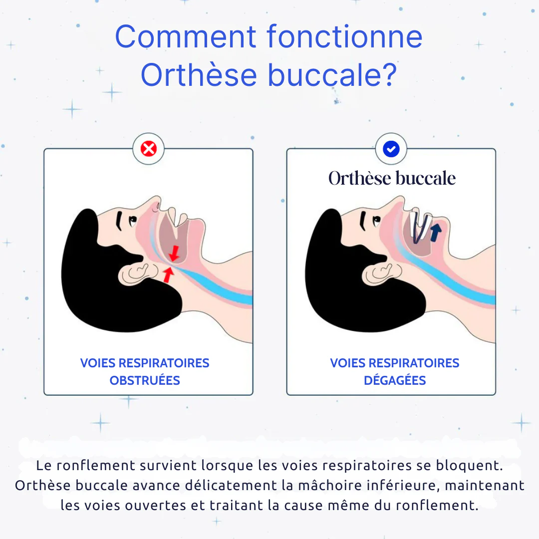 Orthèse buccale pour le sommeil ajustable - Image 7