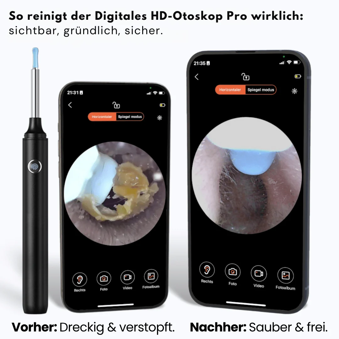 Otoscope numérique HD - Image 3