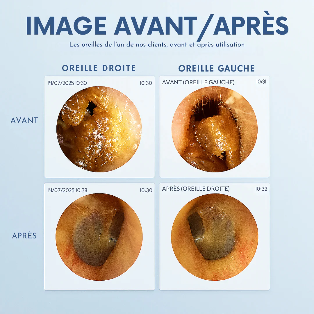 Otoscope vidéo HD - Image 5