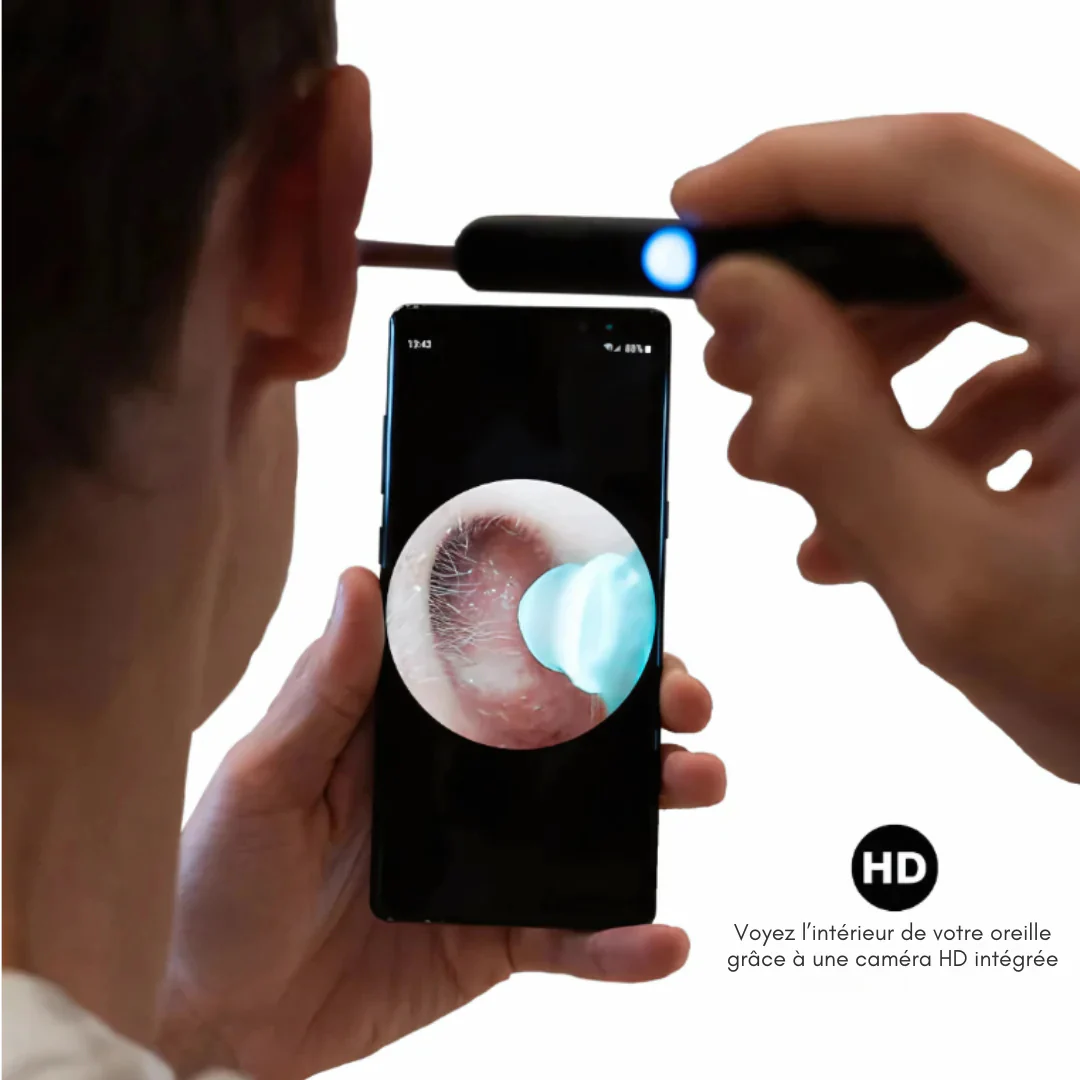 Otoscope vidéo HD - Image 7