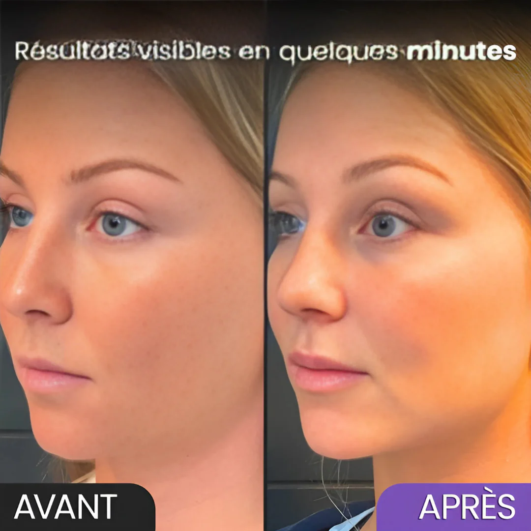 Outil raffermissant visage - Image 2