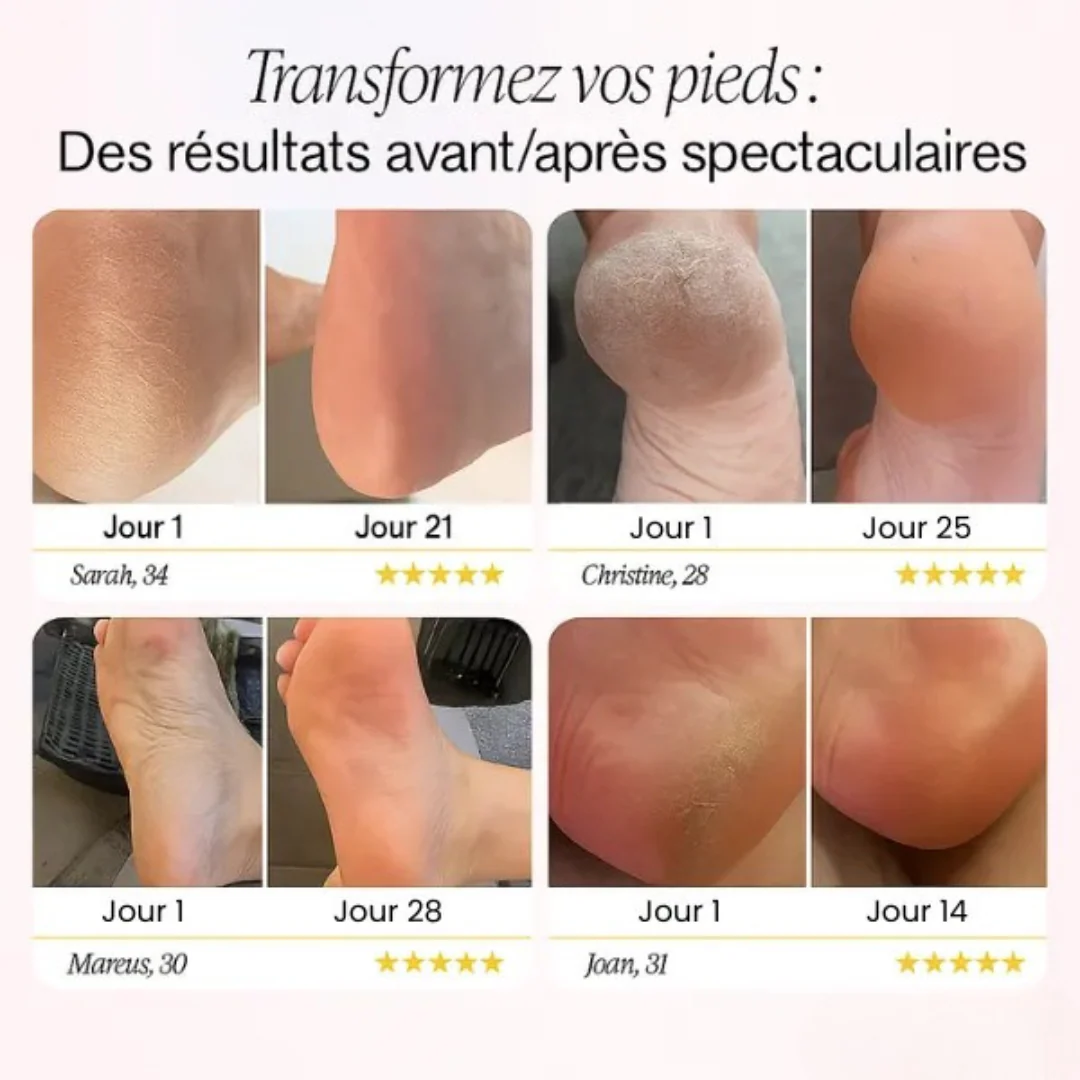Râpe électrique pieds - Image 4