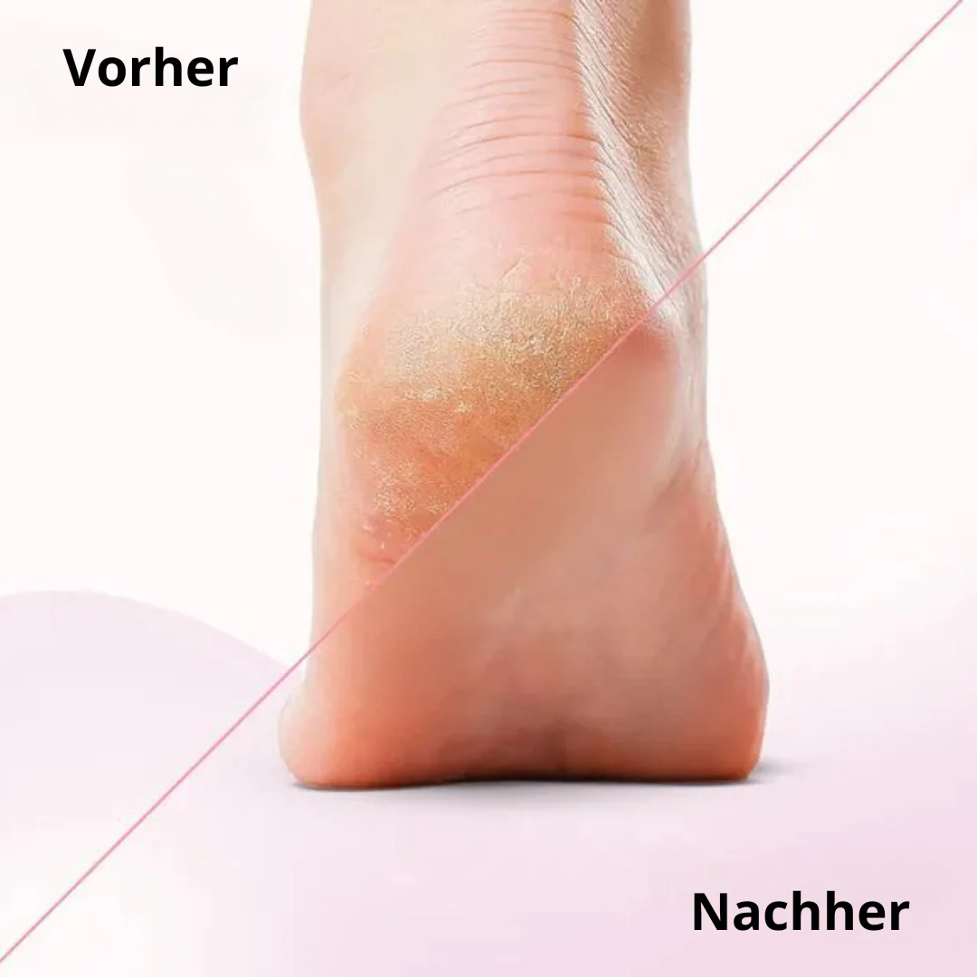 Râpe électrique pour des pieds doux - Image 4