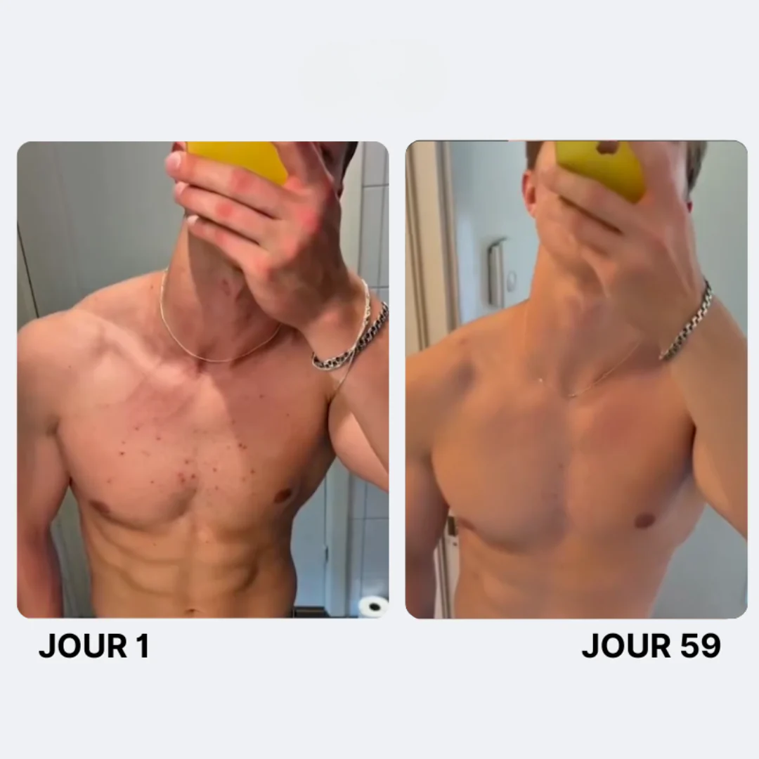 Savon Purifiant Anti-Acné - Image 10