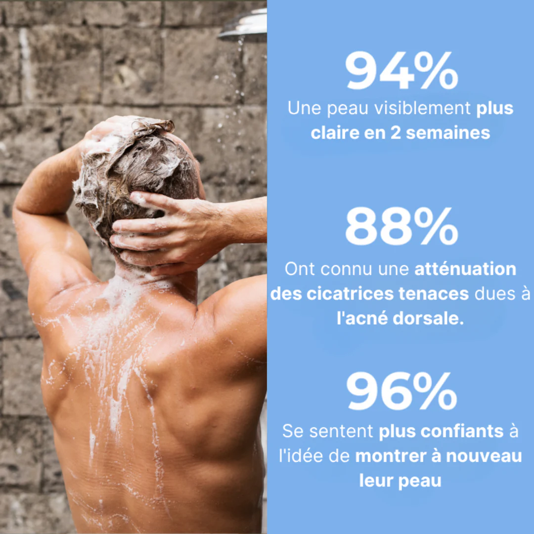 Savon Purifiant Anti-Acné - Image 3