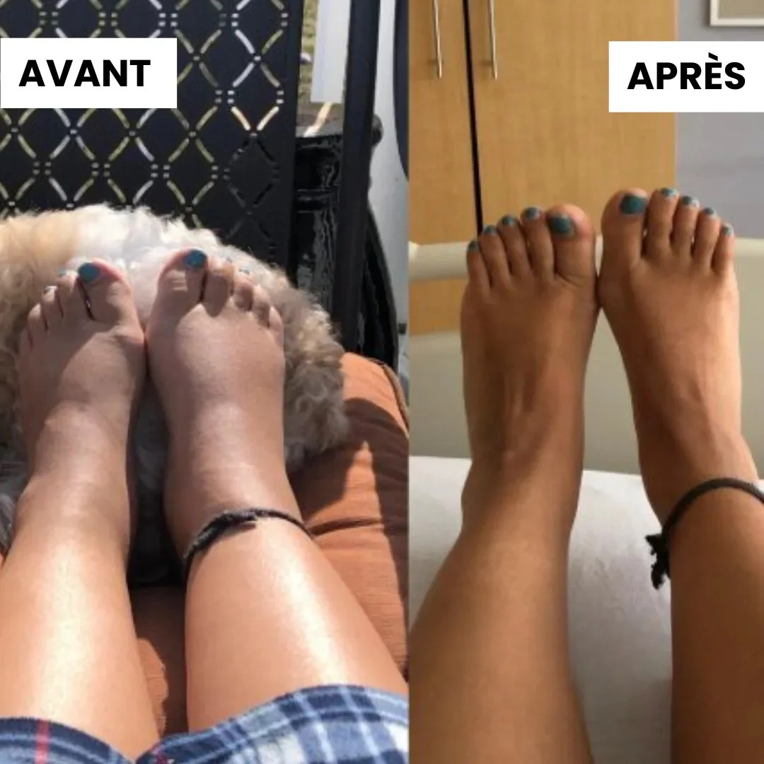 Semelles de massage relaxantes - Image 3