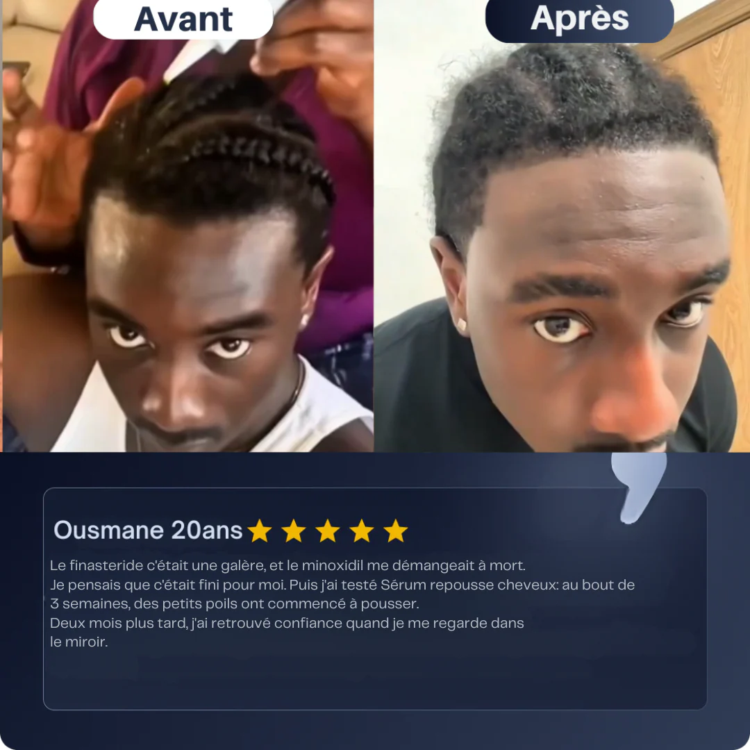 Sérum repousse cheveux - Image 3