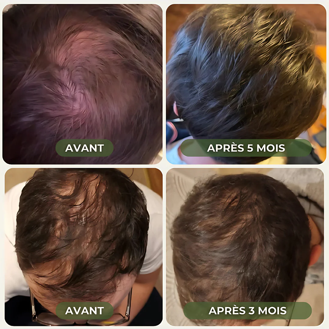 Shampooing Solide Fortifiant Naturel - Image 5