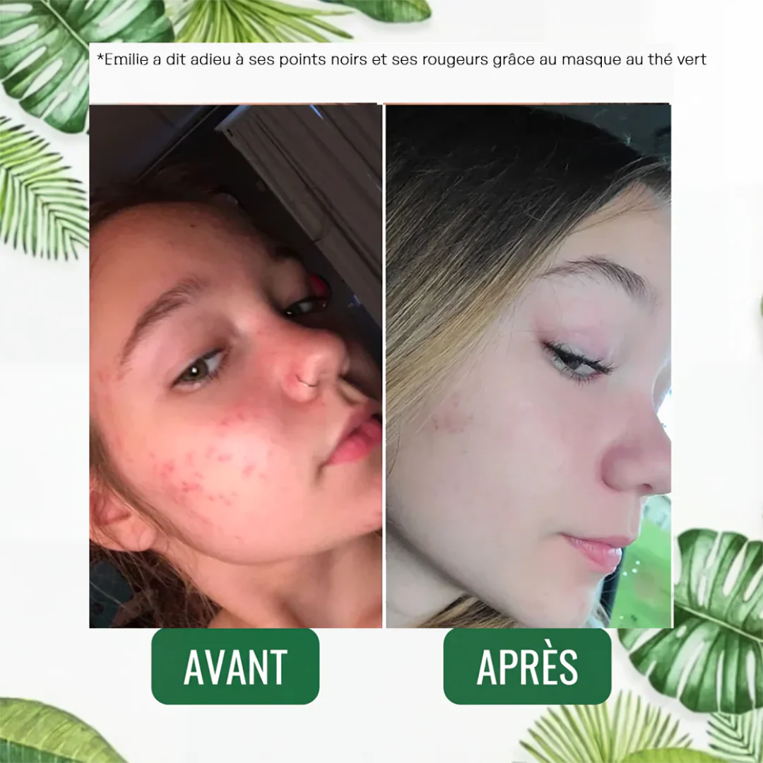 Masque Solide au Thé Vert - Image 6