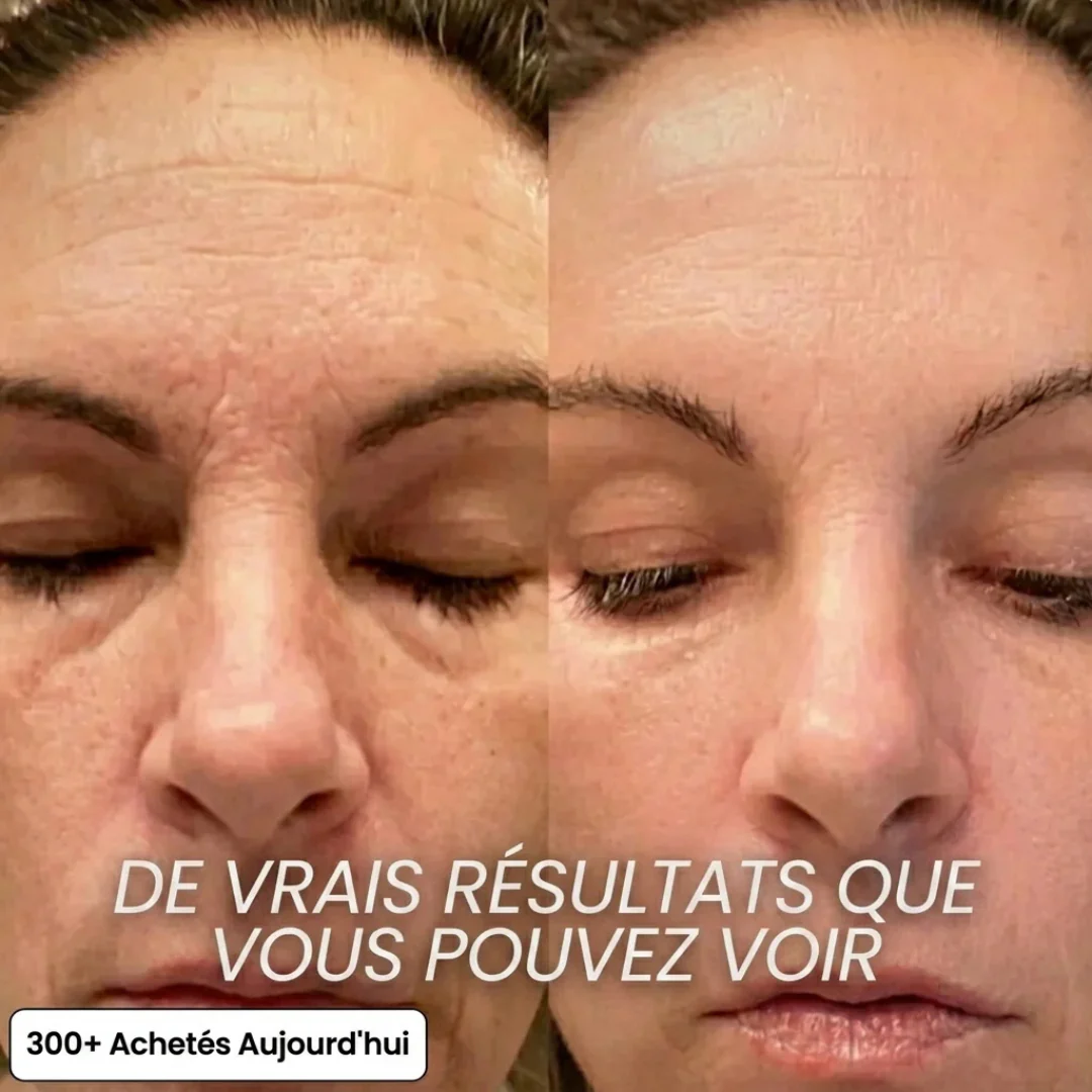 Stick collagène PDRN anti-âge visage - Image 2