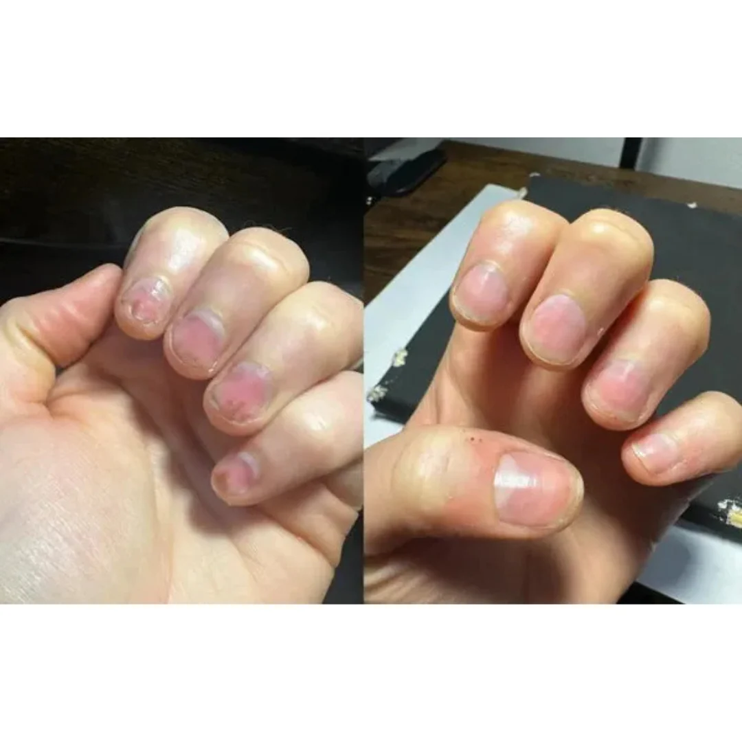 Stylo soin des ongles aux cellules souches - Image 6
