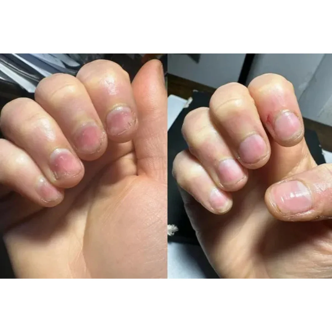 Stylo soin des ongles aux cellules souches - Image 7